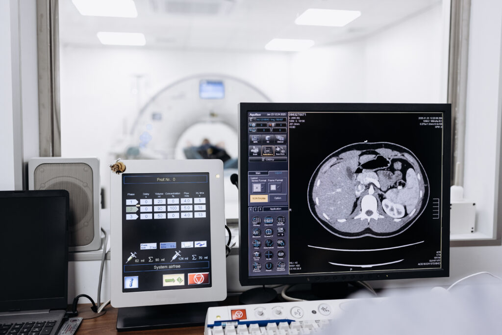 CT scan images displayed on medical monitors in a diagnostic imaging control room during a patient examination